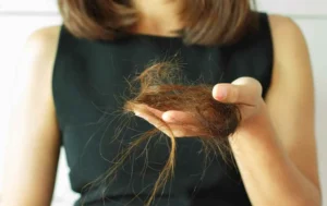 hair-fall_663011809-1 - Daily Health Tips: Simple Tricks for a Healthier Life How to Stop Hair Loss